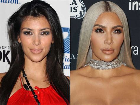 kim kardashian breasts|Kim Kardashian Before And After: Plastic Surgery Timeline.